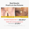Kojic Acid Turmeric Body Peel Shot