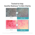Azelaic Acid Capsule Foam Cleanser