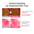 Ultra Light PDRN Pink Peptide Serum