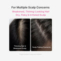 Rosemary PDRN Scalp Serum